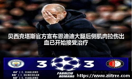 贝西克塔斯官方宣布恩迪迪大腿后侧肌肉拉伤出血已开始接受治疗
